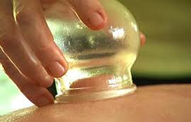 cupping_massage